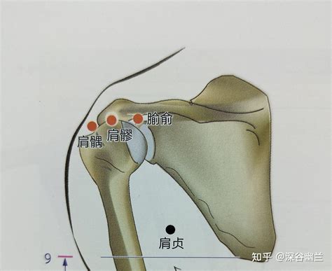 肩真穴|肩髎:命名,穴位解剖,穴位找法,標準定位,取法,操作方法,。